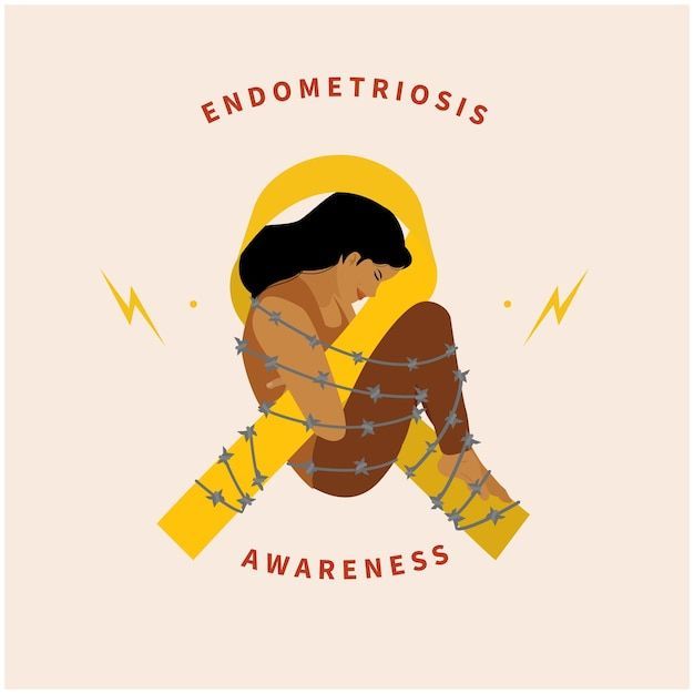 Endometriosis through the lens of TCM and acupuncture